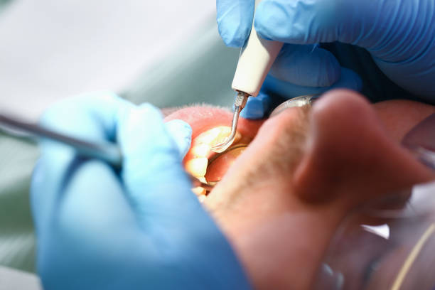 Best Urgent Dental Care for Toothache in Lake Cherokee, TX